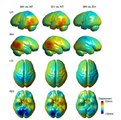 A japán kutatók eredményei: a modern ember és a neandervölgyi, a korai ember és a neandervölgyi, illetve a modern és korai ember agyának összeahasonlítása. A zöld szín a hasonlóságot, a piros az eltéréseket jelzi.