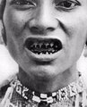 Egy Fülöp-szigeteki bagobo őslakos hegyezett fogakkal, 1910 körül.
