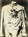 Zsófia hercegnő haslövést kapott, Ferenc Ferdinándnak pedig a nyaki főütőerét érte a golyó. Gyilkosuk is csupán négy évvel élte túl őket: 1918-ban hunyt el csonttuberkulózisban.