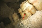 Az altamurai ember alsó fogsorán jelentős mennyiségű lepedéket fedeztek fel