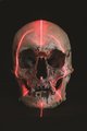 A Tom Baxter által átadott koponya CT-vizsgálata. A számos vizsgálat végeredménye egyértelmű: a koponya nem lehet Kellyé.