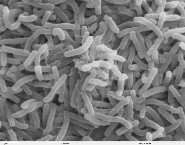A Vibrio cholerae nevű baktérium
