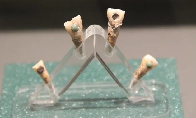 Drágakővel díszített fogak (Nem a tanulmányban említett gyermekfogak.) (Forrás: Wikimedia Commons / Gary Todd / CC0)