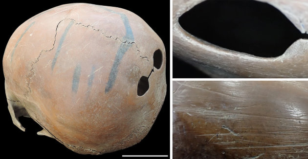 (Forrás: Sawada és mtsai 2025, Tudományos jelentések)