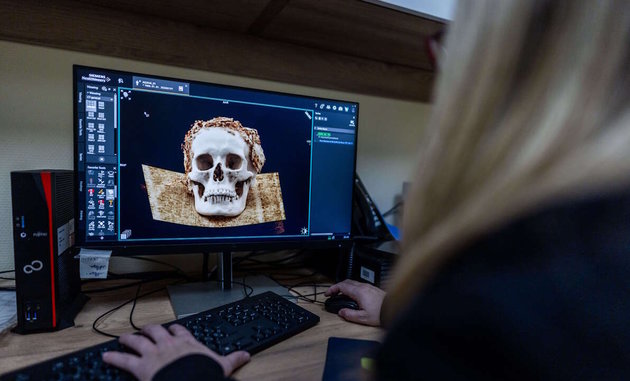 Először vizsgáltak római kori múmiát CT-vel Magyarországon