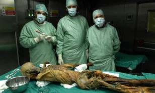 
	A jobb szeme feletti vágás is meggyorsította Ötzi halálát
