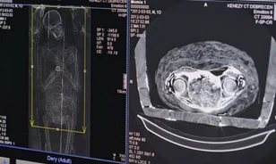 
	Háromezer év várólistán: CT-vizsgálat múmián
