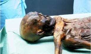 
	Nagyméretű vérömlenyt találtak Ötzi agyában
