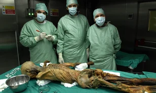 Baktériumok nyomait is kimutatták Ötzi DNS-ében
