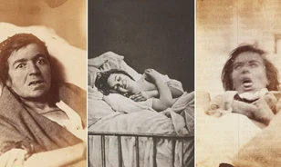 20 különleges portré „női hisztériában” szenvedő páciensekről az 1870-es évekből
