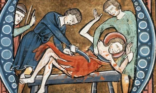 
	Ritkán folyamodtak az elevenen megnyúzás eszközéhez a modern kor előtti Európában

