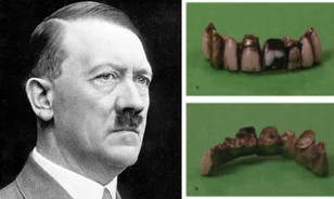 A diktátor fogazata bizonyítja, hogy Hitler valóban meghalt 1945-ben