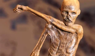 Szív- és érelmeszesedésben szenvedett Ötzi, a jégember