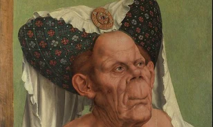 Ritka kórban szenvedhetett Matsys Rút hercegnője