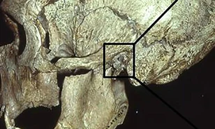 Olyan sok időt tölthettek vízben a neandervölgyiek, hogy sokuknál „úszófül” alakult ki