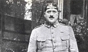 Koponyalékelése miatt Apollinaire fejét élete végéig vaspánt fogta össze