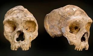 Az egész életükben kiújuló fülgyulladás is hozzájárulhatott a neandervölgyiek kihalásához