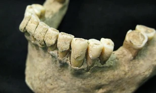 Az őskori emberek fogköve alapján követhető a mezőgazdaság európai elterjedése