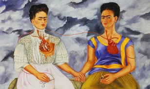Popkulturális ikonná vált az egész életében fájdalmakkal küzdő Frida Kahlo