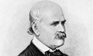 Eredményei ellenére is élesen bírálta az orvostársadalom Semmelweis nézeteit