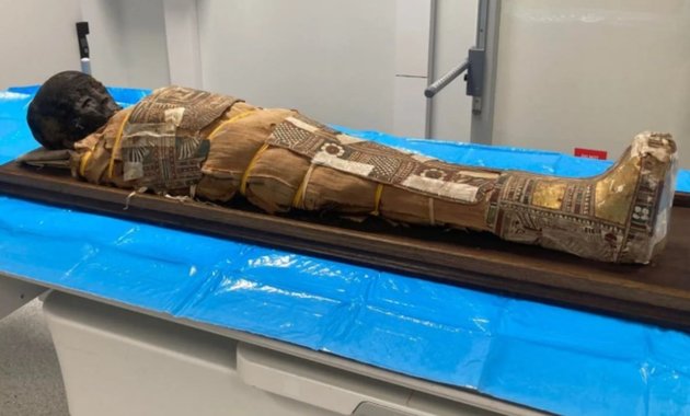 Száz éve őrzött gyermekmúmia titkai tárulnak fel CT-vizsgálatokkal