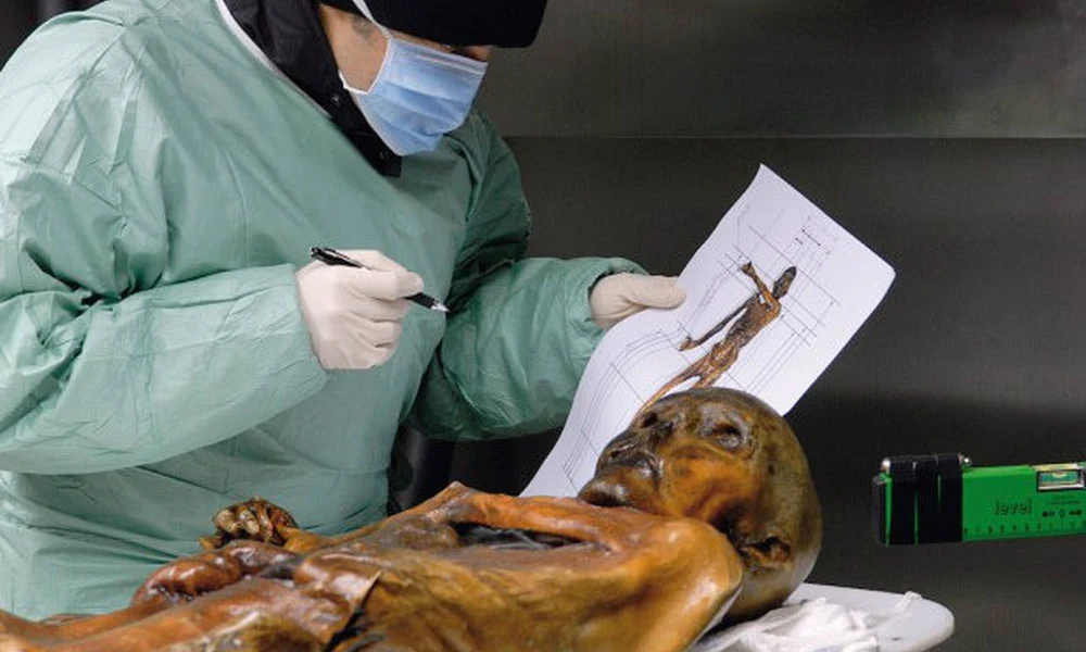 Ötzi