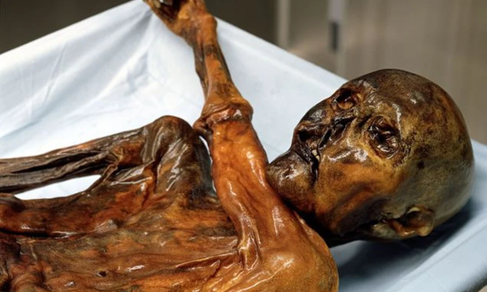 Ötzi