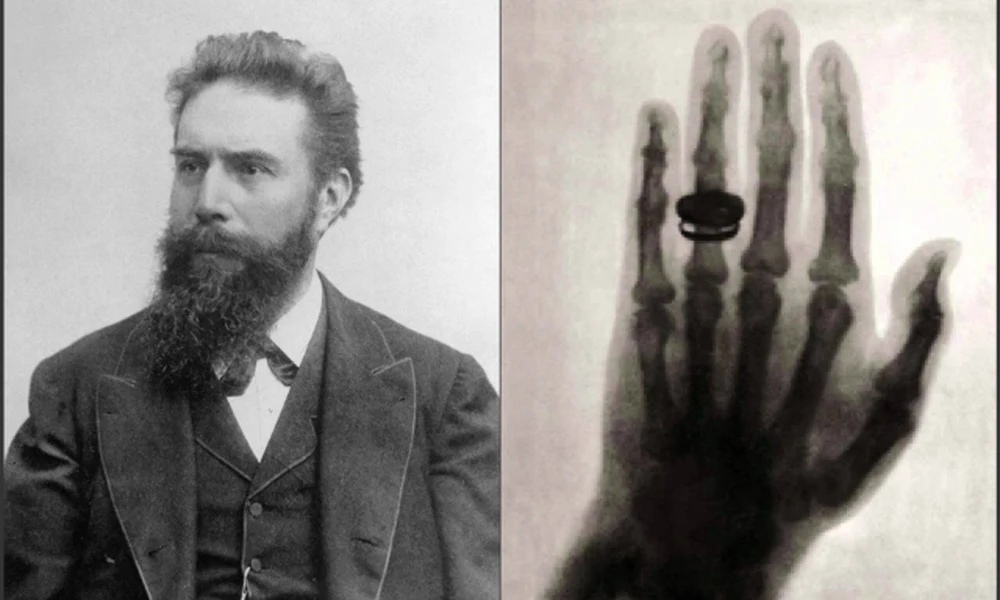 Wilhelm Conrad Röntgen 93 éve halt meg