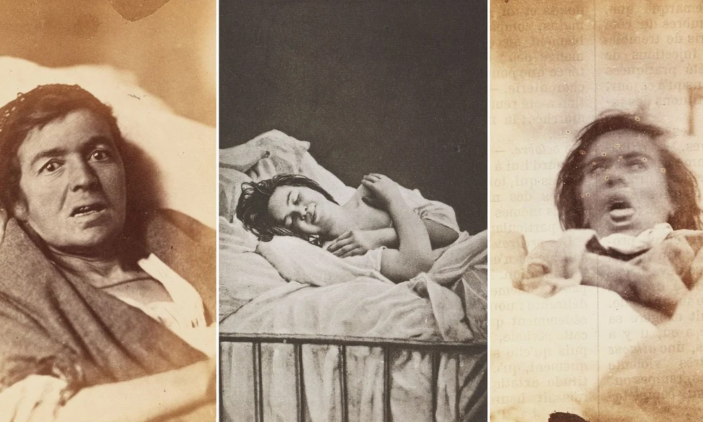 20 különleges portré „női hisztériában” szenvedő páciensekről az 1870-es évekből