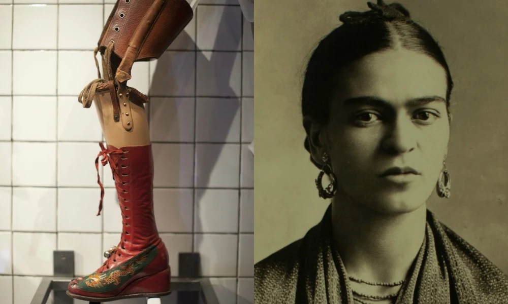 Frida Kahlo és műlába