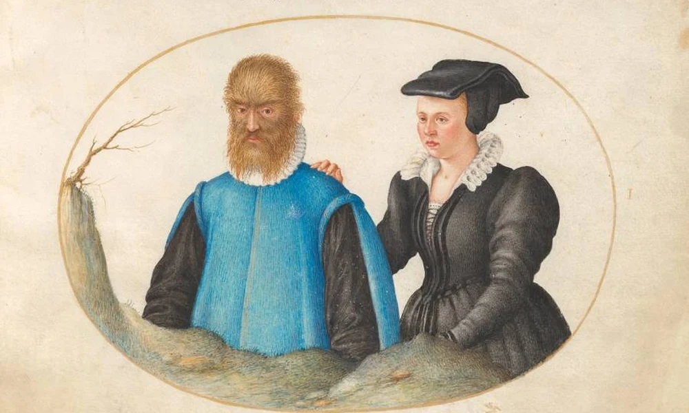Petrus Gonsalvus