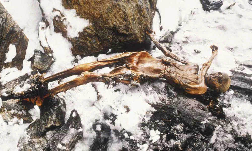 Ötzi