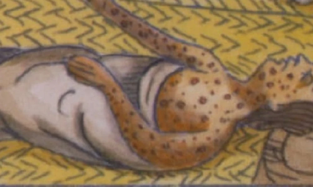 Himlő