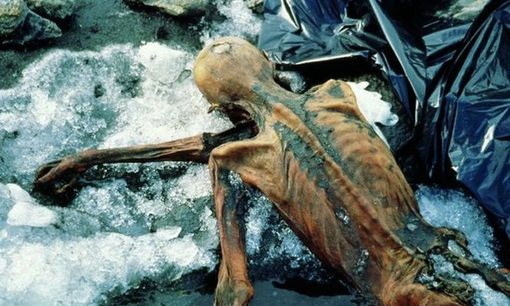 Ötzi