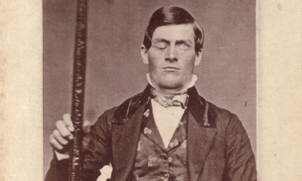 Phineas Gage